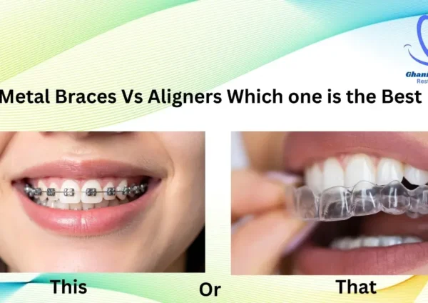 Aligners vs Metal Braces in Lahore – Which Orthodontic Treatment Is Best for You?