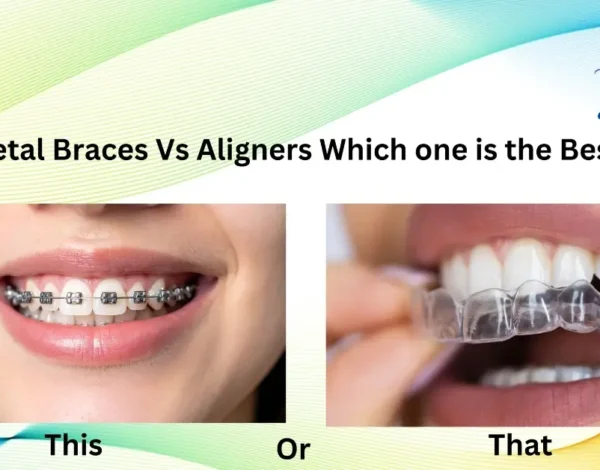 Aligners vs Metal Braces in Lahore – Which Orthodontic Treatment Is Best for You?