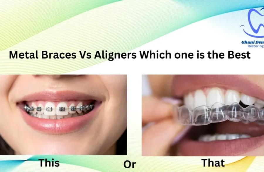 Aligners vs Metal Braces in Lahore – Which Orthodontic Treatment Is Best for You?