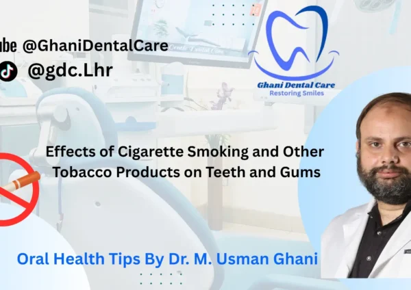 Effects of Smoking & Tobacco on Teeth and Gums Dentist Advice Pakistan